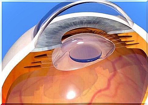 What does cataract surgery involve?