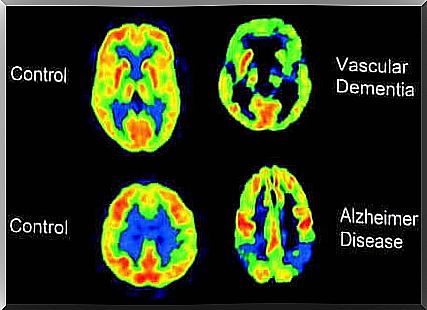 Brain scanner.